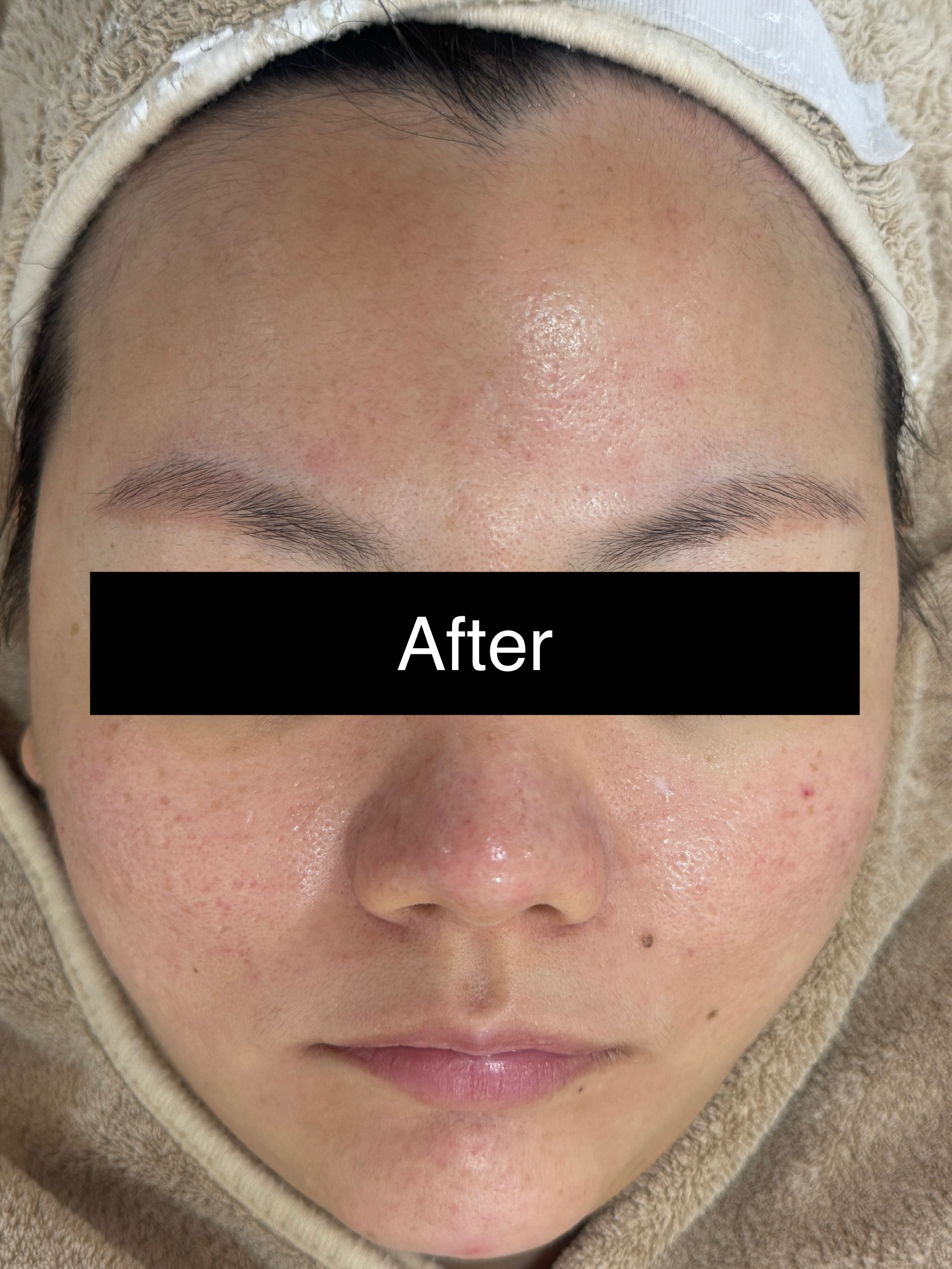 Dry & Dehydrated After