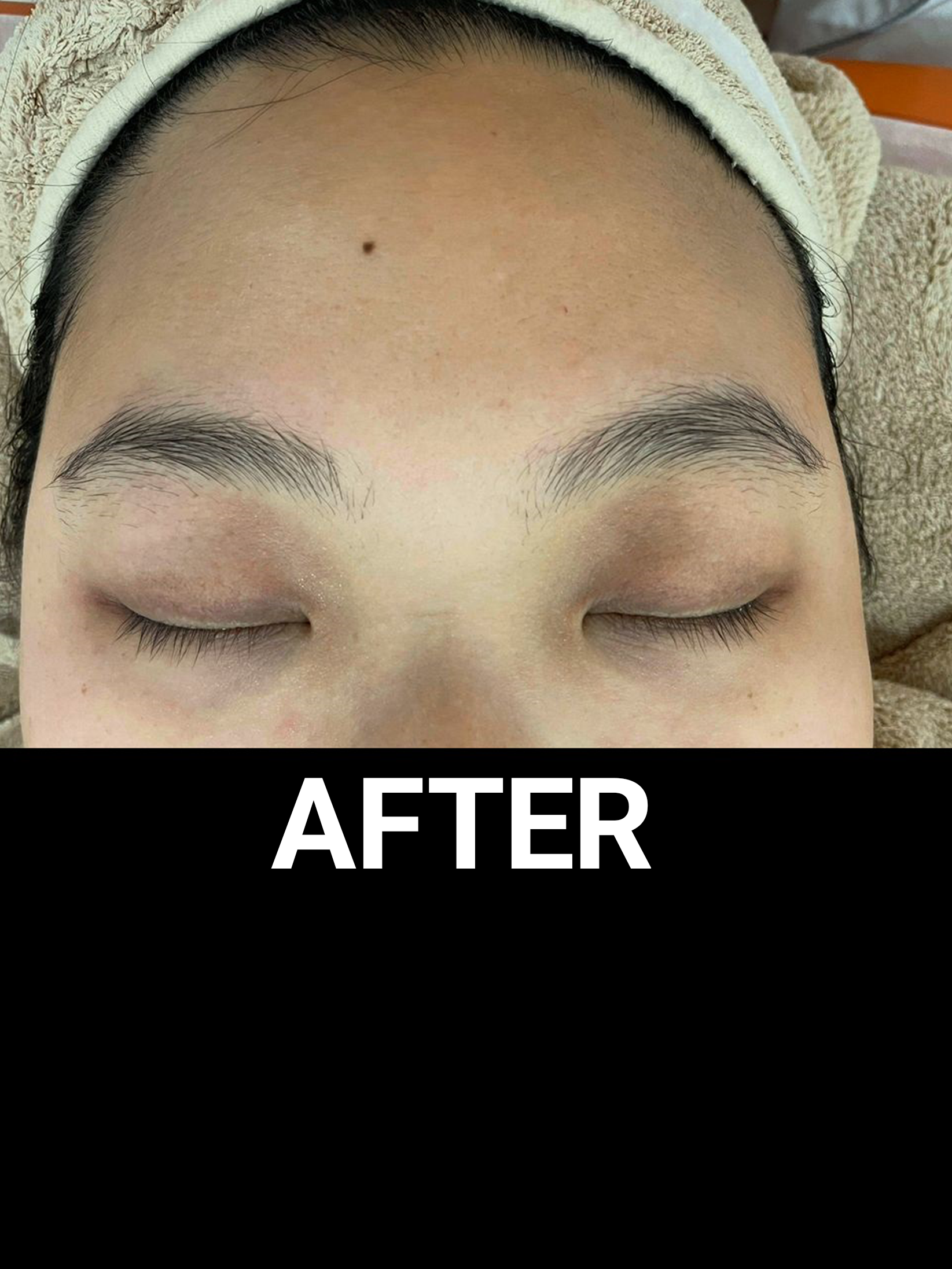 eye spa treatment after