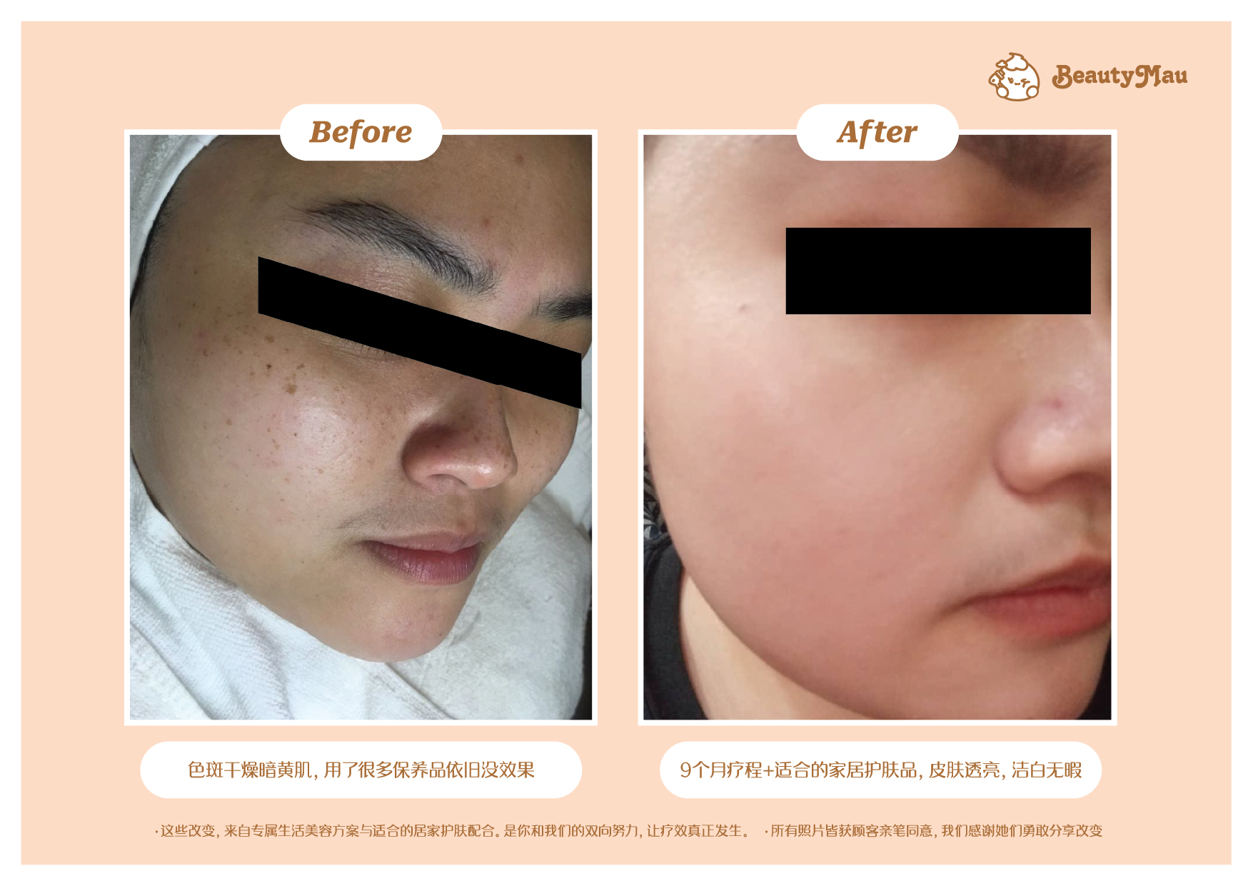 Skin Tag, Wart & Oil Seed before after