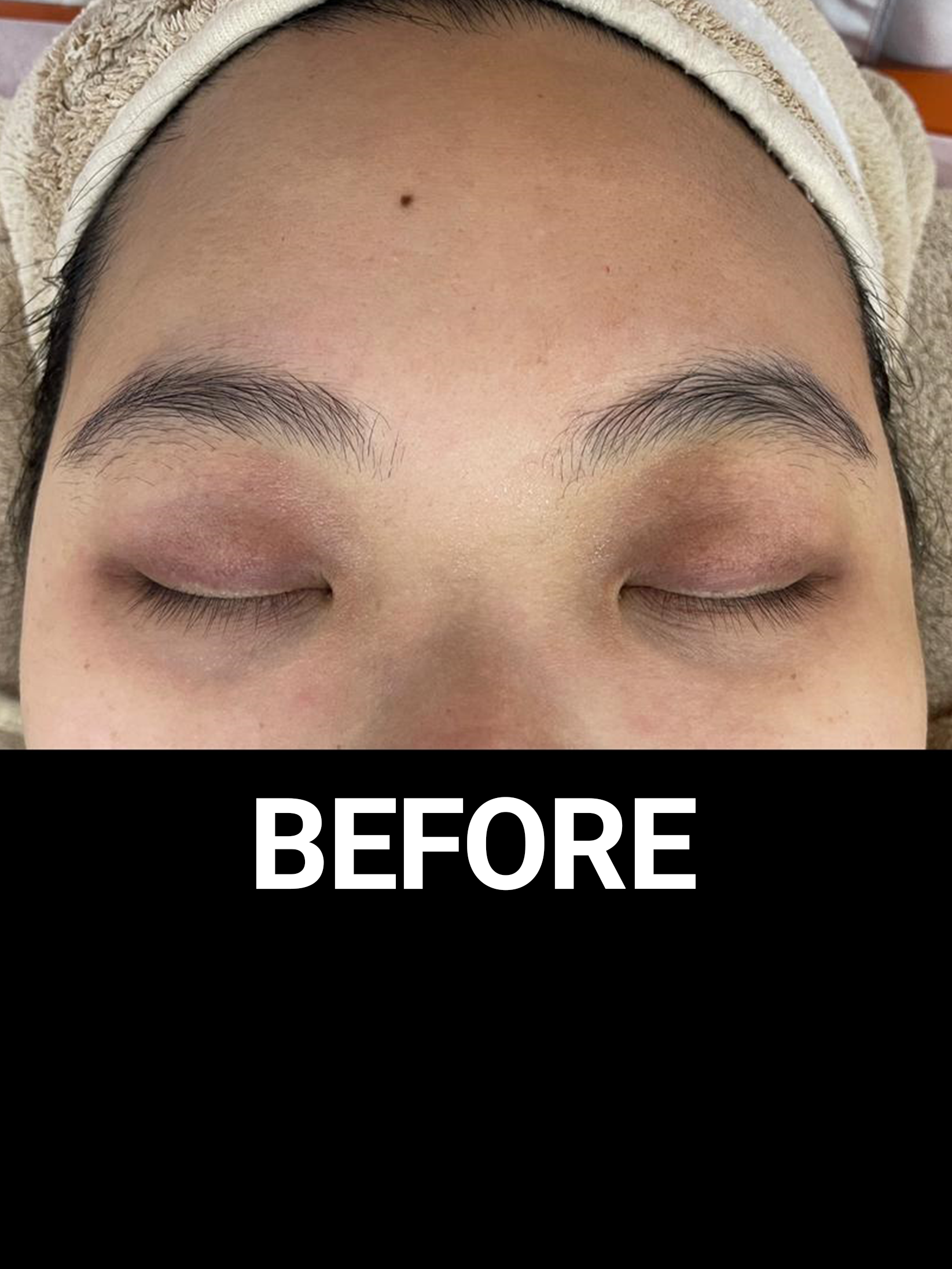 eye spa treatment before eye spa treatment before